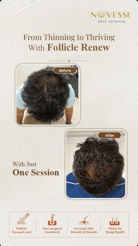 Treatment Result 1