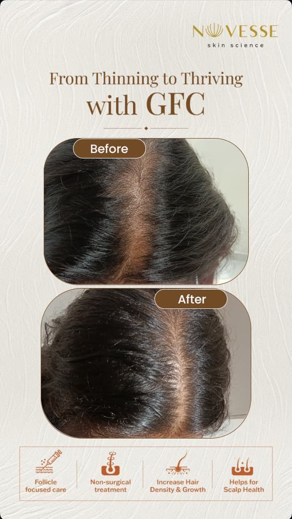 Treatment Result 2