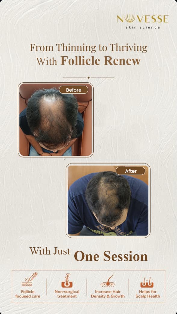 Treatment Result 3