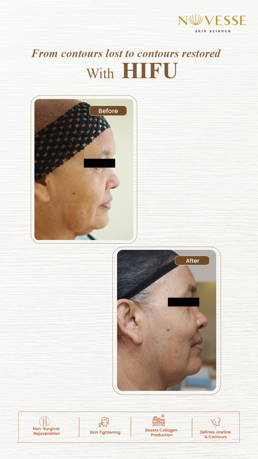 Treatment Result 4