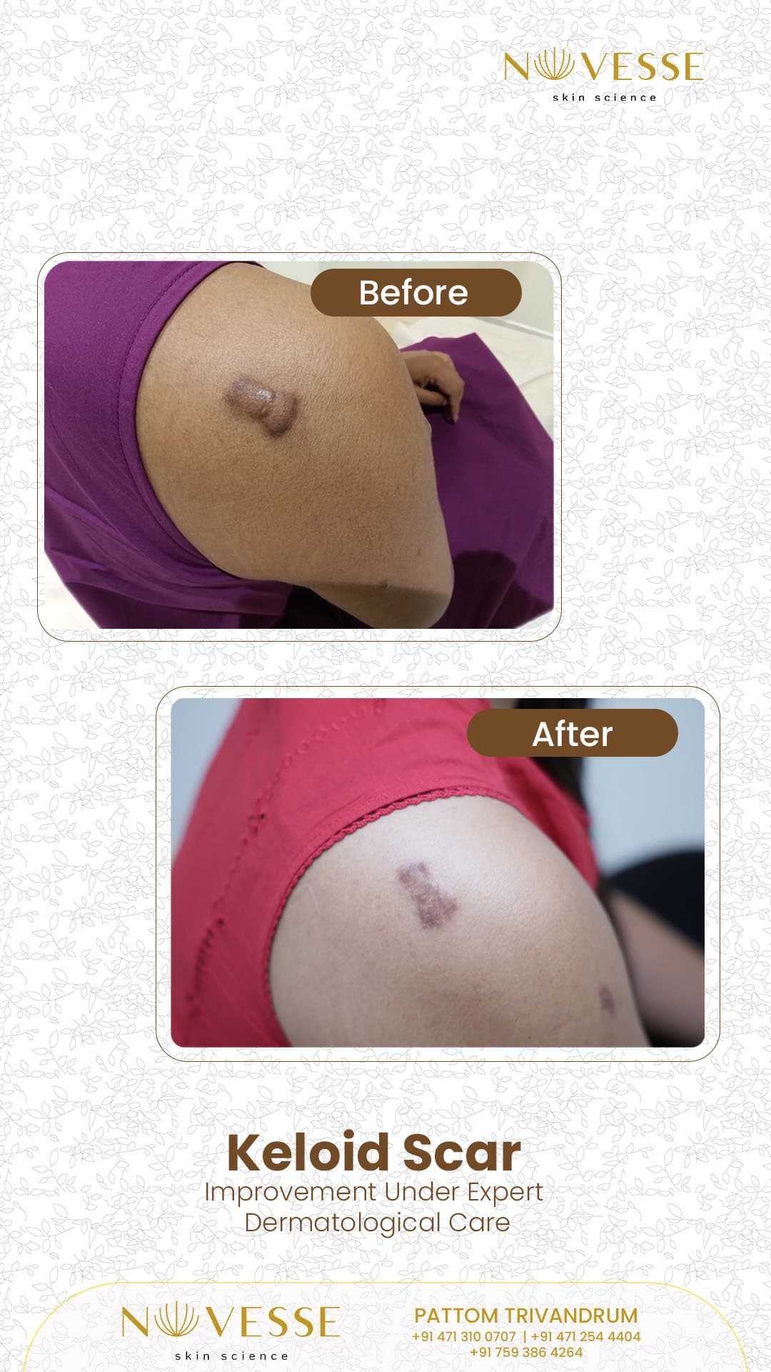 Treatment Result 6