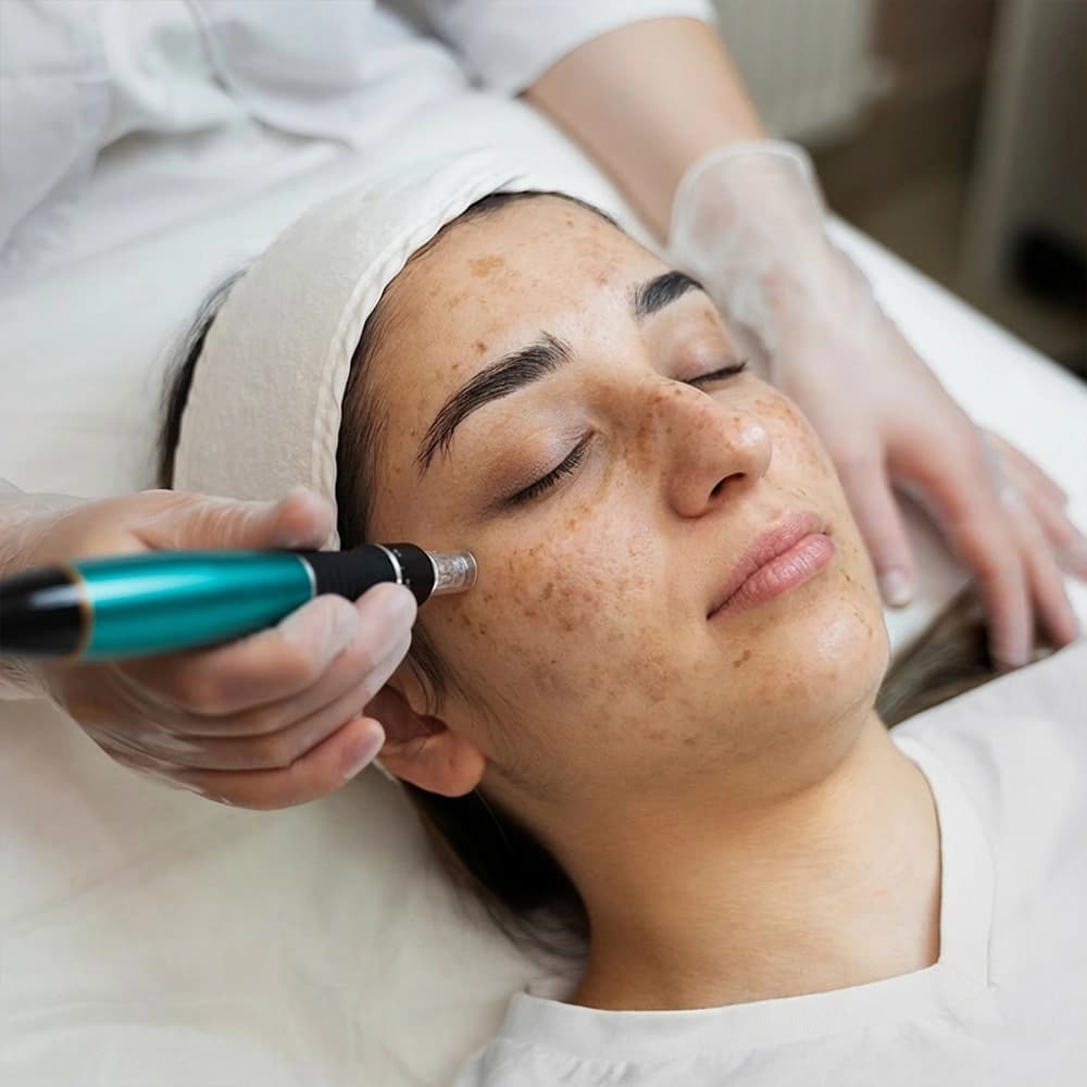 Pigment Control 360°