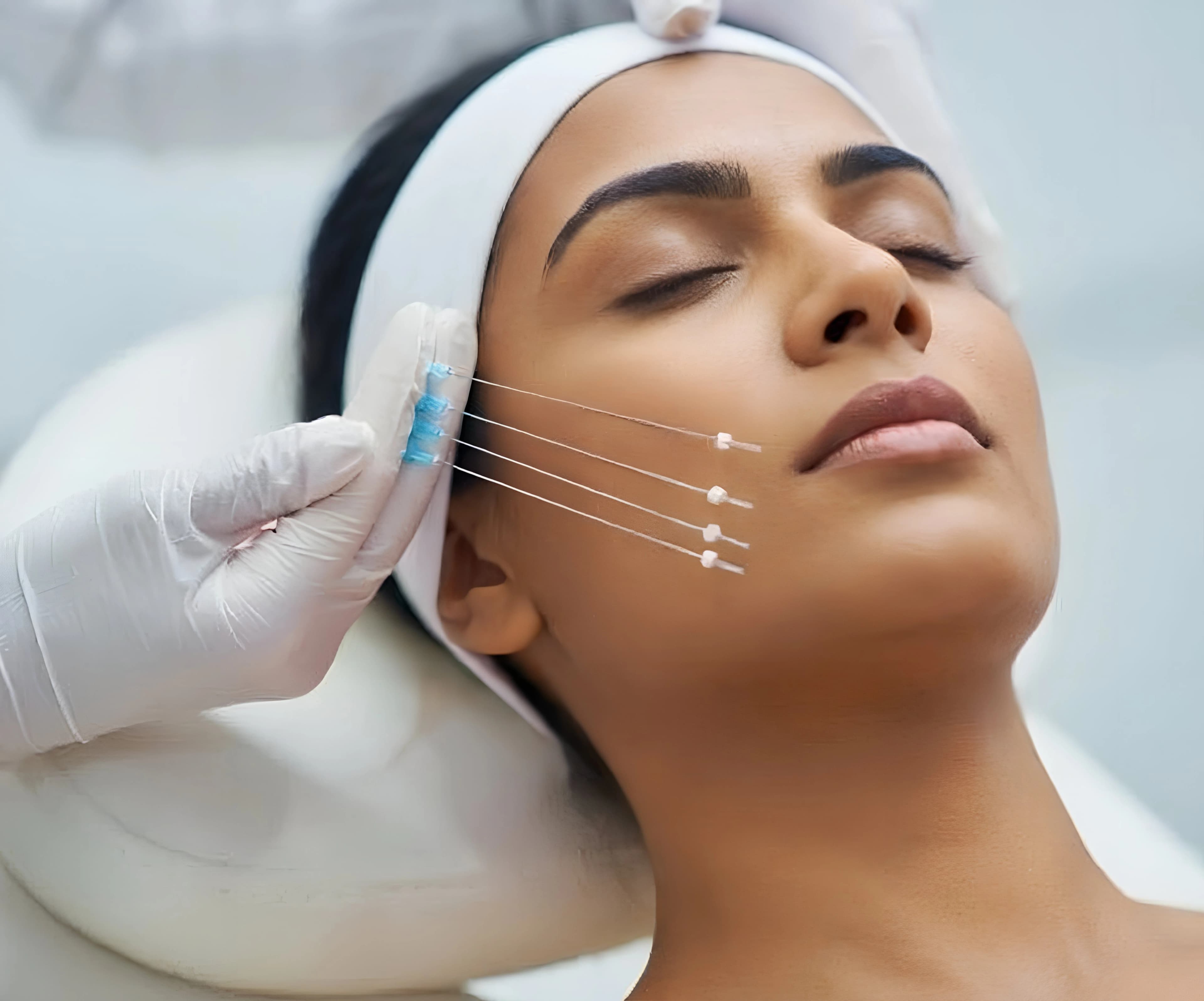 Acne treatment procedure Acne treatment procedure