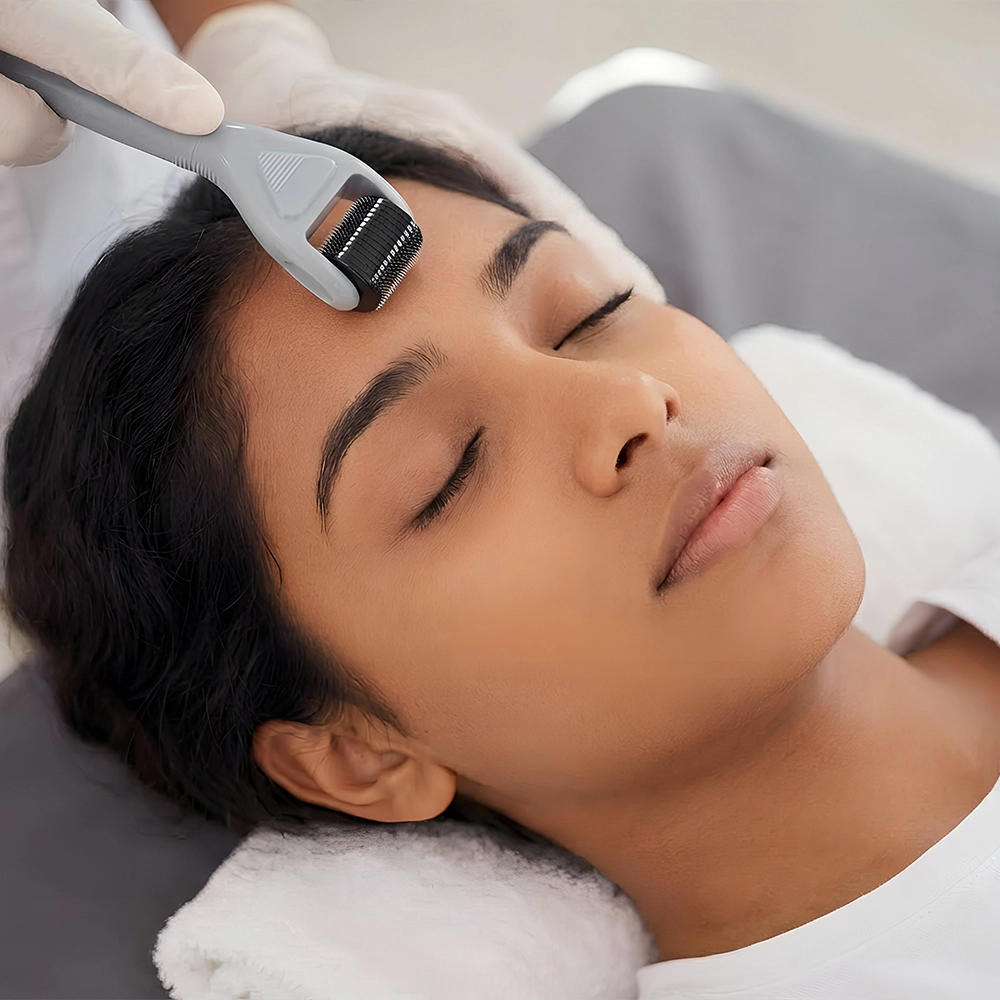 Microneedling / RF Microneedling